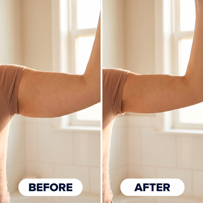 Thermo-Sculpt™ Arm Band